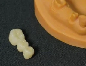 Zastosowania stopów niklu-chromu w instrumentach dentystycznych: solidność, t...